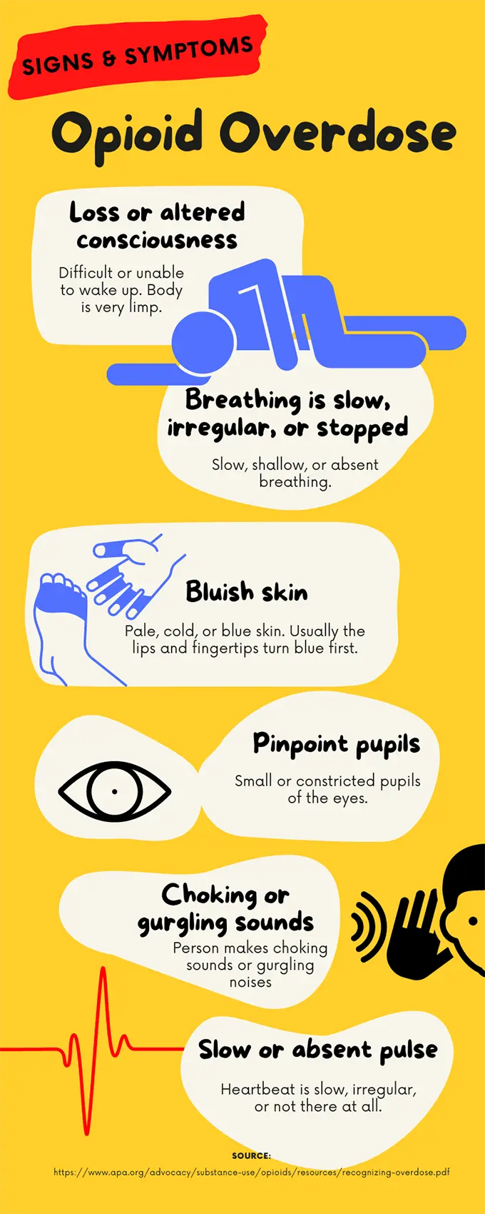 An infographic about the signs and sypmtoms of an opiod overdose. Loss or altered consciousness: difficult or unable to wake up. Body is very limp. Breating is slow, irregular, or stopped: slow, shallow, or absent breathing. Bluish skin: pale, cold, or blue skin. Usually the lips and fingertips turn blue first. Pinpoint pupils: small or constricted pupils of the eyes. Choking or gurgling sounds: person makes choking sounds or gurgling noises. Slow or absent pulse: heartbeat is slow, irregular, or not there at all. The picture has a link to a source that returns a 404, but for reference it says to go here: https://www.apa.org/advocacy/substance-use/opiods/resources/recognizing-overdose.pdf